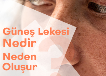 Güneş Lekesi Nedir? Neden Oluşur?