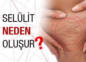 SELÜLİT NEDEN OLUŞUR?